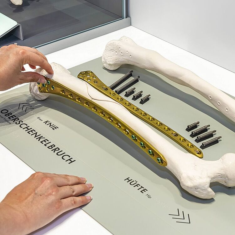 Knochenbruch Knochenbruch Ausstellung Gesundheit